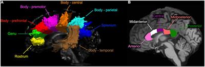 Microstructural organization of the corpus callosum in young endurance athletes: A global tractography study